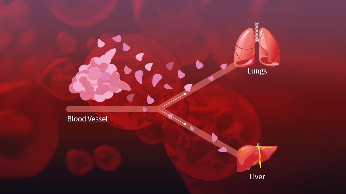 Cancer cell migration arrest image.